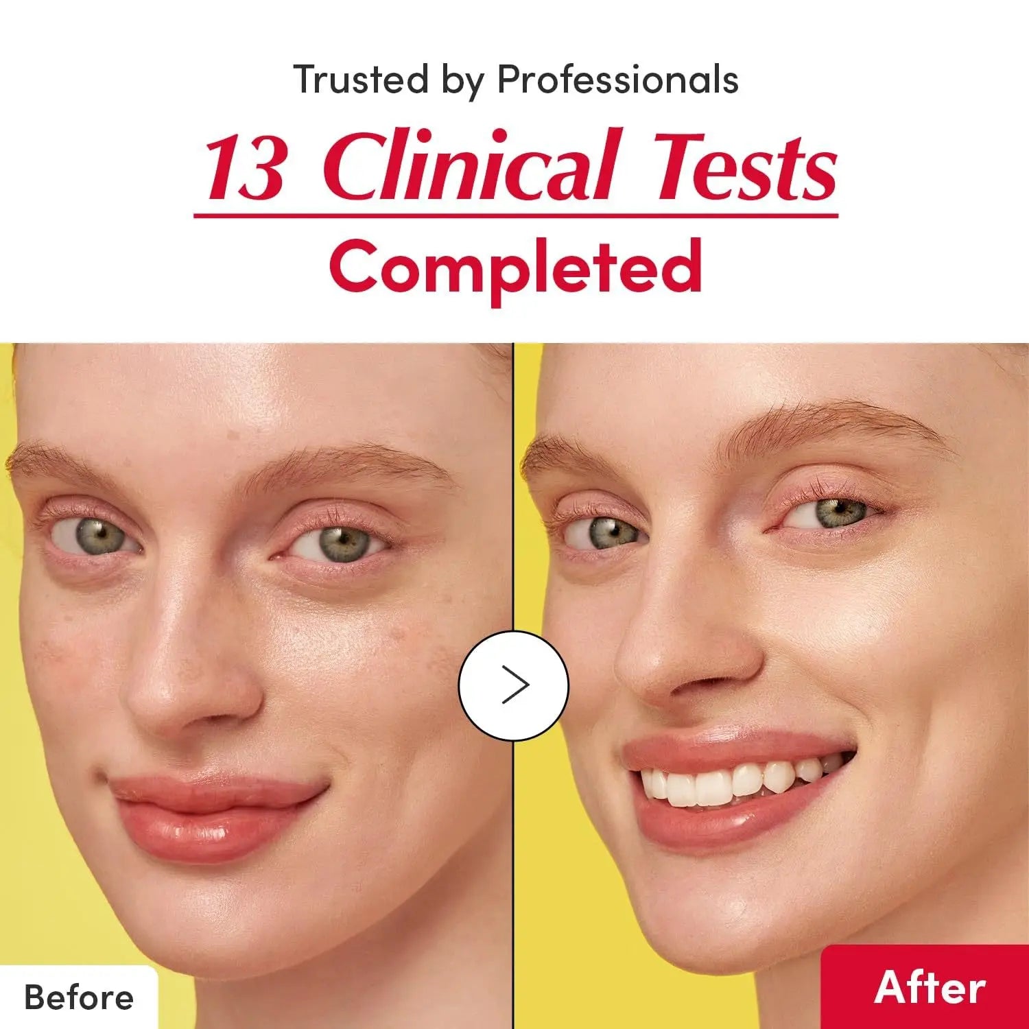 Illumina serum Vitamin™